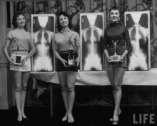 Winners of the Miss Perfect Posture contest at chiropractors convention in Chicago, May 1956, pose with their trophies and x-rays